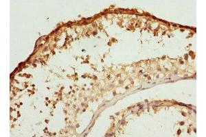 Immunohistochemistry of paraffin-embedded human testis tissue using ABIN7145239 at dilution of 1:100 (BBS2 antibody  (AA 1-96))