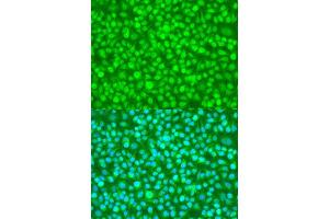 Immunofluorescence analysis of U2OS cells using N4BP1 antibody. (N4BP1 antibody  (AA 190-590))