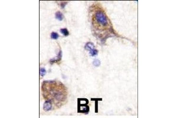 SCYL2 antibody  (C-Term)