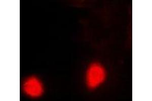Immunofluorescent analysis of PSMD10 staining in Hela cells. (PSMD10 antibody)
