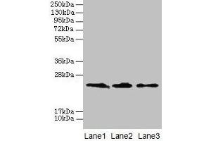 Western blot All lanes: CLDN20 antibody at 4 μg/mL Lane 1: A549 whole cell lysate Lane 2: HepG2 whole cell lysate Lane 3: PC-3 whole cell lysate Secondary Goat polyclonal to rabbit IgG at 1/10000 dilution Predicted band size: 24 kDa Observed band size: 24 kDa (Claudin 2 antibody  (AA 29-81))