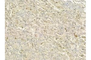 ABIN6258660 and ABIN6274798 at 1/100 staining human normal lung tissue by IHC-P.