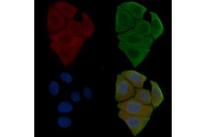 ABIN6255732 and ABIN6267570 staining Hela cells(30 min of UV treatment) by IF/ICC. (ADAM17 antibody  (pThr735))