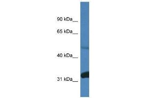anti-Protein Phosphatase 2, Regulatory Subunit B, delta (PPP2R2D) (C-Term) antibody