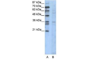 CCNB3 antibody (20R-1100) used at 0. (Cyclin B3 antibody  (N-Term))