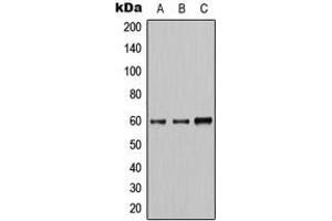 Western blot analysis of AKT expression in HeLa (A), A549 (B), HepG2 (C) whole cell lysates. (AKT1 antibody  (Center))