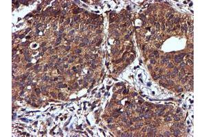 Image no. 9 for anti-NADH Dehydrogenase (Ubiquinone) Complex I, Assembly Factor 7 (NDUFAF7) antibody (ABIN1499667) (NDUFAF7 antibody)