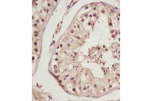 (ABIN6243401 and ABIN6578787) staining NSFL1C in human testis tissue sections by Immunohistochemistry (IHC-P - paraformaldehyde-fixed, paraffin-embedded sections). (NSFL1C antibody  (AA 37-71))