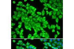 Immunofluorescence analysis of HeLa cells using STIP1 Polyclonal Antibody (STIP1 antibody)