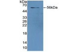 Detection of Recombinant GR, Human using Polyclonal Antibody to Glutathione Reductase (GR) (Glutathione Reductase antibody  (AA 44-522))