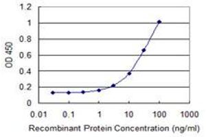 Detection limit for recombinant GST tagged SGOL1 is 0. (Shugoshin antibody  (AA 1-292))