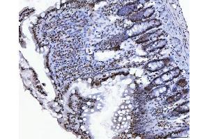 IHC analysis of CTBP2 using anti-CTBP2 antibody (ABIN7601326). (CTBP2 antibody  (AA 321-445))
