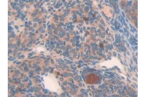 DAB staining on IHC-P; Samples: Mouse Placenta Tissue (NAIP antibody  (AA 500-759))