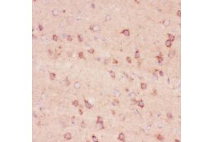 Anti-beta Amyloid Picoband antibody,  IHC(P): Rat Brain Tissue
