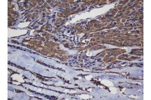 Immunohistochemistry (IHC) image for anti-Crystallin, alpha A (CRYAA) antibody (ABIN1498754) (CRYAA antibody)