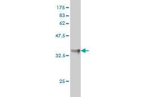 Western Blot detection against Immunogen (37. (KLF11 antibody  (AA 404-512))