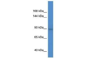 WB Suggested Anti-BCL11A Antibody Titration:  0. (BCL11A antibody  (C-Term))