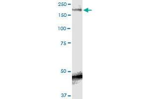 SCN9A monoclonal antibody (M01), clone 5A11. (SCN9A antibody  (AA 269-339))