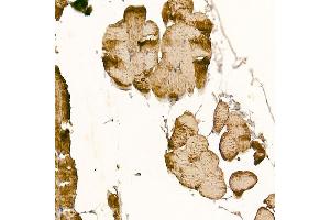 Immunohistochemistry of paraffin-embedded mouse skeletal muscle using CLCN1 Rabbit pAb (ABIN6130939, ABIN6138661, ABIN6138662 and ABIN6221409) at dilution of 1:200 (40x lens). (CLCN1 antibody  (AA 779-988))