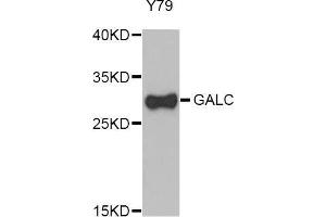 Western Blotting (WB) image for anti-Galactosylceramidase (GALC) (AA 40-300) antibody (ABIN6220405) (GALC antibody  (AA 40-300))