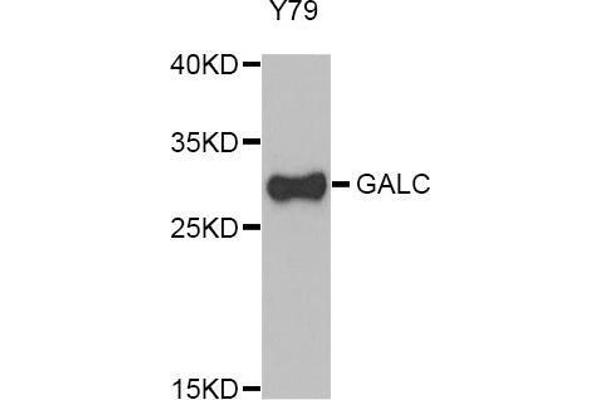 GALC antibody  (AA 40-300)