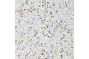 Immunohistochemistry of paraffin-embedded mouse brain using MTTP antibody. (MTTP antibody)