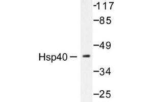 Image no. 2 for anti-DnaJ (Hsp40) Homolog, Subfamily B, Member 1 (DNAJB1) antibody (ABIN265471)