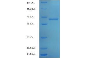 POLR3A Protein (AA 392-632, partial) (His-SUMO Tag)