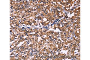 Immunohistochemistry of Human brain  using SELPLG Polyclonal Antibody at dilution of 1:50 (SELPLG antibody)