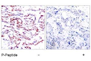 Image no. 1 for anti-Activating Transcription Factor 2 (ATF2) (pThr53), (pThr71) antibody (ABIN196667) (ATF2 antibody  (pThr53, pThr71))