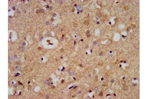 IHC image of ABIN7169072 diluted at 1:500 and staining in paraffin-embedded human brain tissue performed on a Leica BondTM system. (CDC42BPB antibody  (AA 1609-1711))