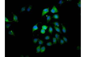 Immunofluorescence staining of A549 cells with ABIN7146652 at 1:166, counter-stained with DAPI. (CLIP2 antibody  (AA 101-217))