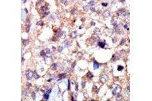 Immunohistochemistry (IHC) image for anti-C-Abl Oncogene 1, Non-Receptor tyrosine Kinase (ABL1) (AA 851-881) antibody (ABIN3030214)