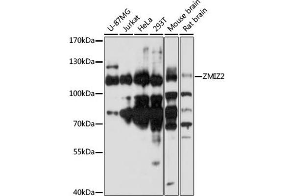 ZMIZ2 antibody  (AA 1-110)