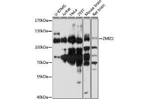 ZMIZ2 anticorps  (AA 1-110)