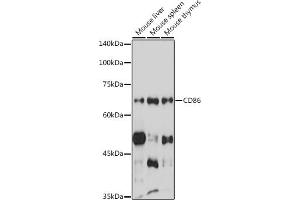 Western blot analysis of extracts of various cell lines, using CD86 antibody (ABIN6131556, ABIN6138237, ABIN6138238 and ABIN6219508) at 1:1000 dilution. (CD86 antibody  (AA 30-247))
