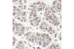 Immunohistochemistry (IHC) image for anti-Protein-Kinase, Interferon-Inducible Double Stranded RNA Dependent Inhibitor, Repressor of (p58 Repressor) (PRKRIR) (AA 150-200) antibody (ABIN7448742)