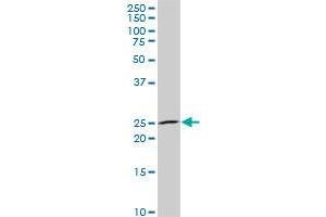 NKX3-1 monoclonal antibody (M02), clone 1C7. (NKX3-1 antibody  (AA 100-209))