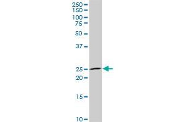 NKX3-1 antibody  (AA 100-209)