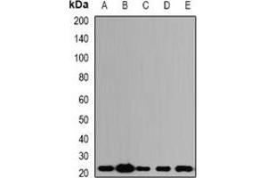 Western blot analysis of ALG-2 expression in SW620 (A), HepG2 (B), mouse kidney (C), mouse lung (D), rat ovary (E) whole cell lysates. (ALG2 antibody)