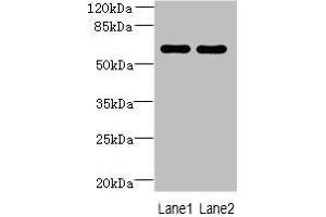 Western blot All lanes: ZNF215 antibody at 3 μg/mL Lane 1: Hela whole cell lysate Lane 2: A431 whole cell lysate Secondary Goat polyclonal to rabbit IgG at 1/10000 dilution Predicted band size: 61, 36 kDa Observed band size: 61 kDa (ZNF215 antibody  (AA 12-304))