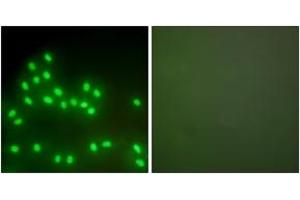 Immunofluorescence analysis of A549 cells, using Ku70/80 Antibody. (Ku70/80 (AA 683-732) antibody)