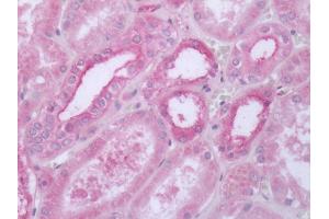 Human Kidney: Formalin-Fixed, Paraffin-Embedded (FFPE) (5HT1D antibody  (Cytoplasmic Domain))