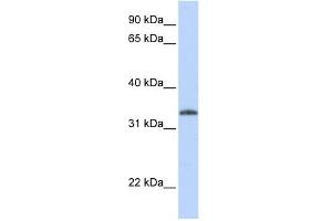 WB Suggested Anti-UCK2 Antibody Titration:  0. (UCK2 antibody  (N-Term))