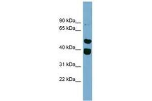 Image no. 1 for anti-Tripartite Motif Containing 49 (TRIM49) (AA 359-408) antibody (ABIN6744234) (TRIM49 antibody  (AA 359-408))
