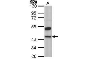 WB Image Sample (30 ug of whole cell lysate) A: Molt-4 , 10% SDS PAGE antibody diluted at 1:1000 (KNG1 antibody)