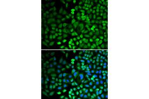 Immunofluorescence analysis of HeLa cells using APEX1 antibody (ABIN5970467).