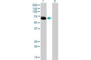 Western Blot analysis of RIPK2 expression in transfected 293T cell line by RIPK2 monoclonal antibody (M01), clone 2C7. (RIPK2 antibody  (AA 431-540))