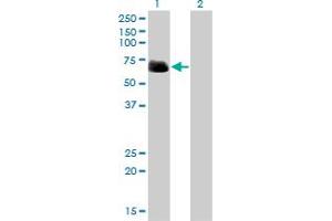 Western Blot analysis of RIPK2 expression in transfected 293T cell line by RIPK2 monoclonal antibody (M01), clone 2C7.