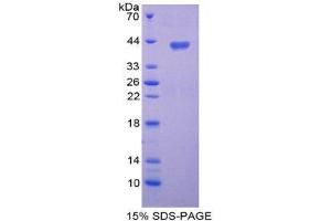 SDS-PAGE (SDS) image for Chemokine (C-C Motif) Ligand 3-Like 1 (CCL3L1) (AA 1-93) protein (His tag,GST tag) (ABIN2122610)